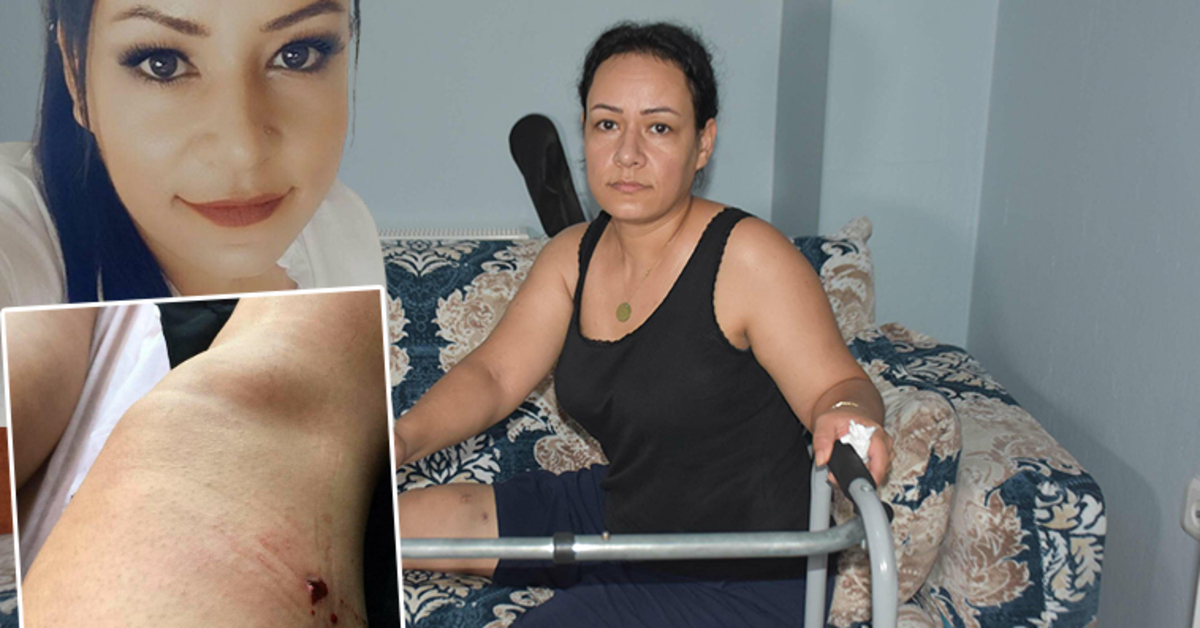 Aysel’i yaralayan eski eş için ağırlaştırılmış müebbet talebi