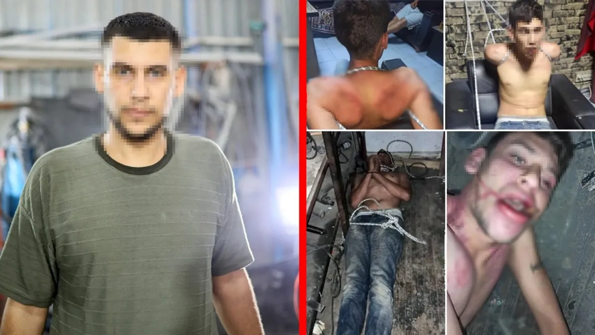 Antalya’da tüyler ürperten olay: 3 gün işkence gördü! Böcek yedirildi! İşte o vahşet anları!